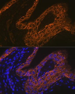 Invitrogen Cytokeratin 13 Recombinant Rabbit Monoclonal Antibody (5M6B10)