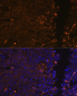 Invitrogen Cytokeratin 13 Recombinant Rabbit Monoclonal Antibody (5M6B10)