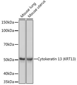 Invitrogen Cytokeratin 13 Recombinant Rabbit Monoclonal Antibody (5M6B10)