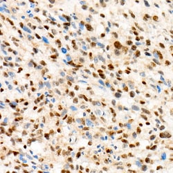 Invitrogen TFE3 Recombinant Rabbit Monoclonal Antibody (7V8M1) 100 &mu;L;