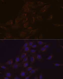 Invitrogen PIST Recombinant Rabbit Monoclonal Antibody (2B1P9) 100 &mu;L;