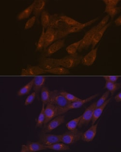 Invitrogen PIST Recombinant Rabbit Monoclonal Antibody (2B1P9) 100 &mu;L;