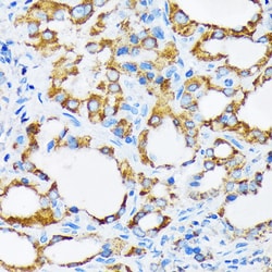 Invitrogen PIST Recombinant Rabbit Monoclonal Antibody (2B1P9) 100 &mu;L;