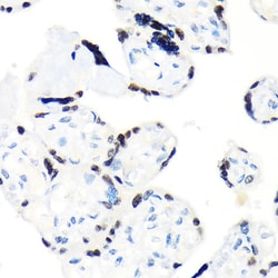 Invitrogen RCC1 Recombinant Rabbit Monoclonal Antibody (1F0C5) 100 &mu;L;