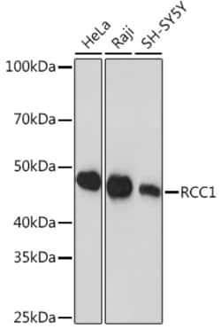 Invitrogen RCC1 Recombinant Rabbit Monoclonal Antibody (1F0C5) 100 &mu;L;