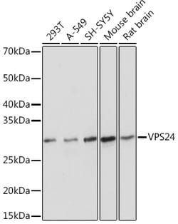 Invitrogen CHMP3 Recombinant Rabbit Monoclonal Antibody (1L10B7) 100 &mu;L;