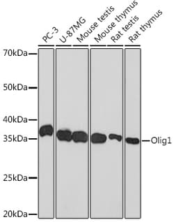Invitrogen&trade;&nbsp;OLIG1 Recombinant Rabbit Monoclonal Antibody (7E4B2)