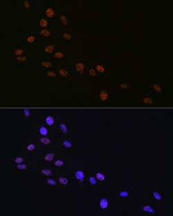 Invitrogen MATR3 Recombinant Rabbit Monoclonal Antibody (10O1D1) 100 &mu;L;