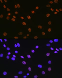 Invitrogen MATR3 Recombinant Rabbit Monoclonal Antibody (10O1D1) 100 &mu;L;