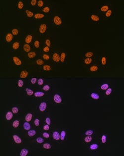 Invitrogen MATR3 Recombinant Rabbit Monoclonal Antibody (10O1D1) 100 &mu;L;
