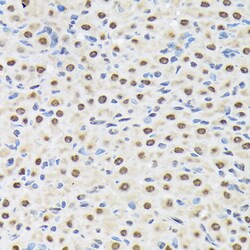 Invitrogen MATR3 Recombinant Rabbit Monoclonal Antibody (10O1D1) 100 &mu;L;