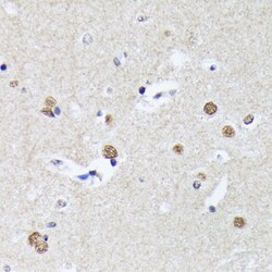 Invitrogen MATR3 Recombinant Rabbit Monoclonal Antibody (10O1D1) 100 &mu;L;