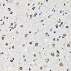Invitrogen MATR3 Recombinant Rabbit Monoclonal Antibody (10O1D1) 100 &mu;L;