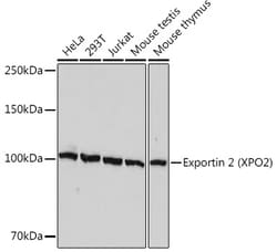 Invitrogen CAS Recombinant Rabbit Monoclonal Antibody (1W4T4) 100 &mu;L;
