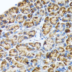 Invitrogen HYOU1 Recombinant Rabbit Monoclonal Antibody (6H7X2) 100 &mu;L;