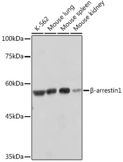 Invitrogen beta Arrestin 1 Recombinant Rabbit Monoclonal Antibody (F7C2)