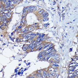 Invitrogen PKC alpha Recombinant Rabbit Monoclonal Antibody (1G10S8) 100