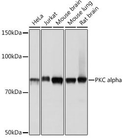 Invitrogen PKC alpha Recombinant Rabbit Monoclonal Antibody (1G10S8) 100