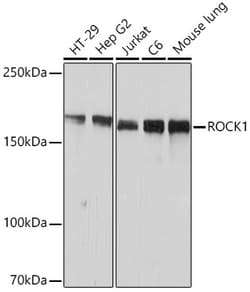 Invitrogen ROCK1 Recombinant Rabbit Monoclonal Antibody (H5E4) 100 &mu;L;