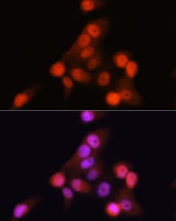 Invitrogen p16INK4a Recombinant Rabbit Monoclonal Antibody (0D0C8) 100