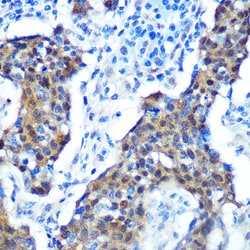 Invitrogen p16INK4a Recombinant Rabbit Monoclonal Antibody (0D0C8) 100