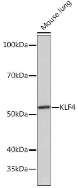 Invitrogen KLF4 Recombinant Rabbit Monoclonal Antibody (7B7U1) 100 &mu;L;