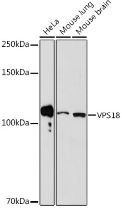 VPS18 Recombinant Rabbit Monoclonal Antibody (ARC2156), Invitrogen 100