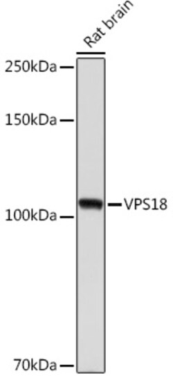 VPS18 Recombinant Rabbit Monoclonal Antibody (ARC2156), Invitrogen 100
