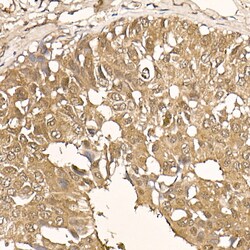 Invitrogen AKT1 Recombinant Rabbit Monoclonal Antibody (10S9D6) 100 &mu;L;