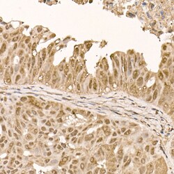 Invitrogen AKT1 Recombinant Rabbit Monoclonal Antibody (10S9D6) 100 &mu;L;