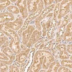 Invitrogen AKT1 Recombinant Rabbit Monoclonal Antibody (10S9D6) 100 &mu;L;