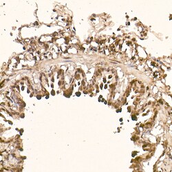 Invitrogen AKT1 Recombinant Rabbit Monoclonal Antibody (10S9D6) 100 &mu;L;