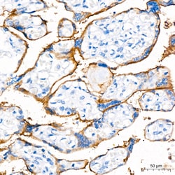 Invitrogen PD-L1 (CD274) Recombinant Rabbit Monoclonal Antibody (8E4V4) 100 &mu;L | Buy Online | Invitrogen&trade; | Fisher Scientific