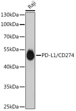 Invitrogen PD-L1 (CD274) Recombinant Rabbit Monoclonal Antibody (8E4V4) 100 &mu;L | Buy Online | Invitrogen&trade; | Fisher Scientific