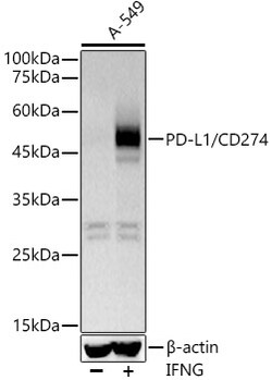 Invitrogen PD-L1 (CD274) Recombinant Rabbit Monoclonal Antibody (8E4V4) 100 &mu;L | Buy Online | Invitrogen&trade; | Fisher Scientific