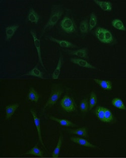 Invitrogen PKA alpha Monoclonal Antibody 100 &mu;L | Buy Online | Invitrogen&trade; | Fisher Scientific