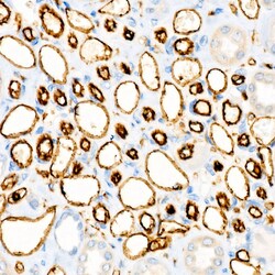 Invitrogen CD31 (PECAM-1) Recombinant Rabbit Monoclonal Antibody (7O7K3)