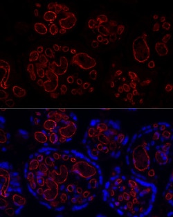 Invitrogen CD31 (PECAM-1) Recombinant Rabbit Monoclonal Antibody (7O7K3)