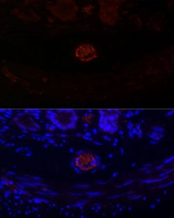 Invitrogen CD31 (PECAM-1) Recombinant Rabbit Monoclonal Antibody (7O7K3)