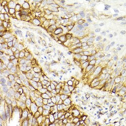 Invitrogen CD29 (Integrin beta 1) Recombinant Rabbit Monoclonal Antibody