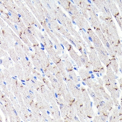 Invitrogen N-cadherin Recombinant Rabbit Monoclonal Antibody (6F9G8) 100
