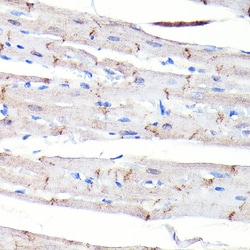 Invitrogen N-cadherin Recombinant Rabbit Monoclonal Antibody (6F9G8) 100
