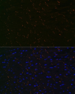 Invitrogen N-cadherin Recombinant Rabbit Monoclonal Antibody (6F9G8) 100