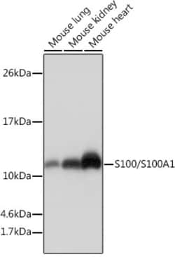 Invitrogen S100A1 Recombinant Rabbit Monoclonal Antibody (5L10L1) 100 &mu;L;