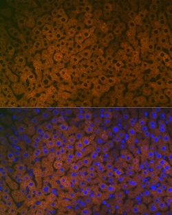 Invitrogen FMO3 Recombinant Rabbit Monoclonal Antibody (6Q10X9) 100 &mu;L;
