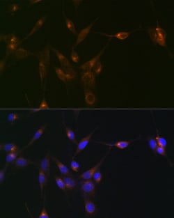 Invitrogen PDLIM1 Recombinant Rabbit Monoclonal Antibody (5X10L2) 100 &mu;L;