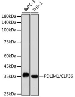 Invitrogen PDLIM1 Recombinant Rabbit Monoclonal Antibody (5X10L2) 100 &mu;L;