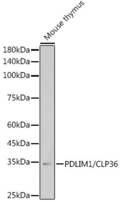 Invitrogen PDLIM1 Recombinant Rabbit Monoclonal Antibody (5X10L2) 100 &mu;L;