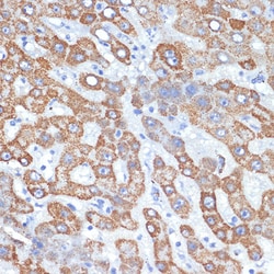 Invitrogen HMGCS2 Recombinant Rabbit Monoclonal Antibody (5T5T3) 100 &mu;L;