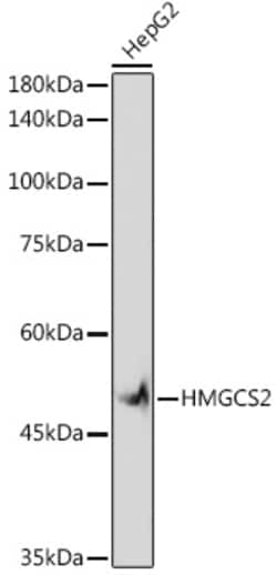 Invitrogen HMGCS2 Recombinant Rabbit Monoclonal Antibody (5T5T3) 100 &mu;L;